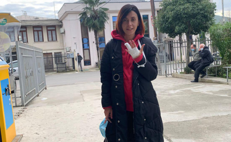 წითლიძის თქმით, პოლიციის მიერ მოტეხილ თითზე ოპერაცია დასჭირდება