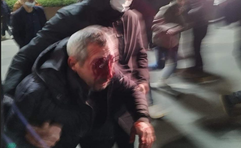 რუსთაველის გამზირზე აქციის მონაწილე დშავდა 