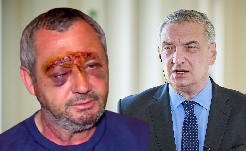 მხედველობის დაკარგვასთან დაკავშირებით გარკვეული შეკითხვები არსებობს - ვოლსკი აქციაზე დაშავებულზე
