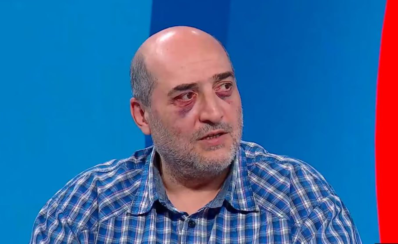 ვინ შეუკვეთა თავდასხმა მიშა მშვილდაძეზე და ჰყავდა თუ არა დაკავებულს თანამზარხველები?