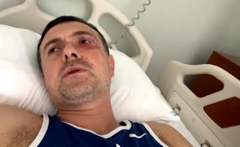 ნაცემი ირაკლი ეძგვერაძის და მისი დაშავებული მეგობრების მდგომარეობა დამძიმდა
