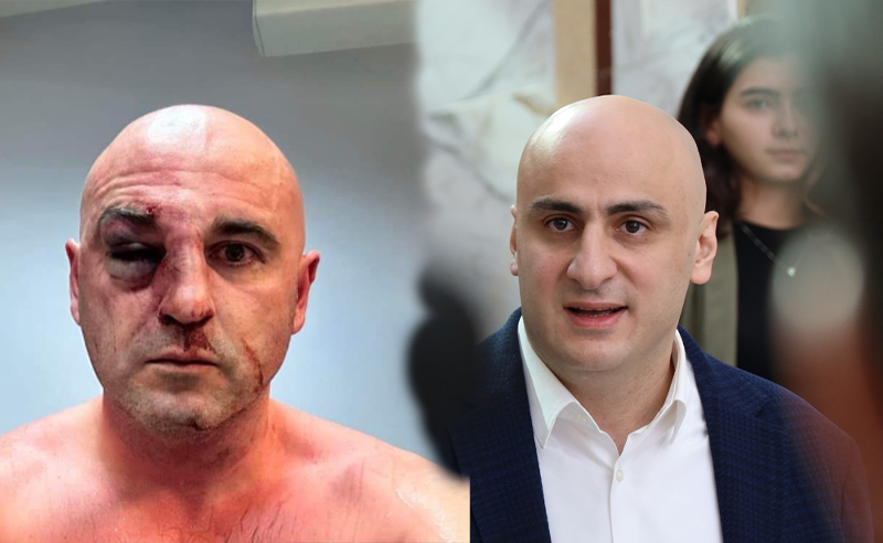 ასე პოლიტიკურ ოპონენტებს მხოლოდ რუსეთში ექცევიან - მელია ხაბეიშვილის ცემაზე