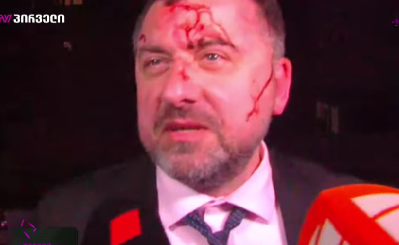 ბეისბოლის ბიტებივით ჯოხები მირტყეს, მეუბნებოდნენ რატომ ვეწინააღმდეგები რუსულ კანონს - გია ჯაფარიძე