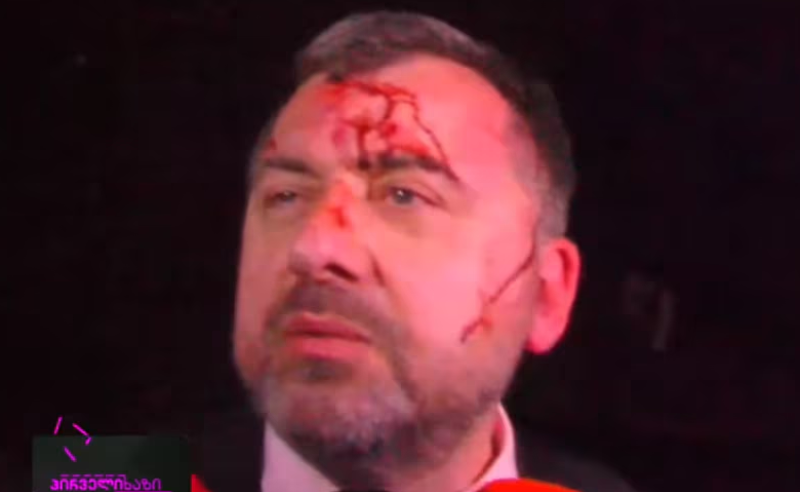 თავზე ნაკერი ადევს, აქვს ტვინის შერყევა - როგორია გია ჯაფარიძის მდგომარეობა