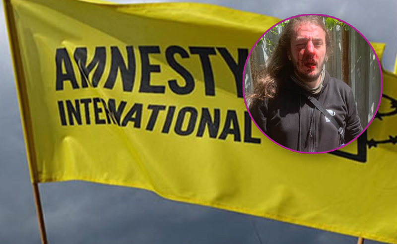 თავდასხმა ზუკა ბერძენიშვილზე - Amnesty International-ის შეფასებით, ხელისუფლების ქმედებები აქტივისტებზე ძალადობას "მწვანე შუქს უნთებს"