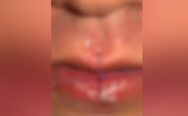 "ევოლუშენ ჯორჯიას" გაფიცულმა თანამშრომელმა პირი ამოიკერა