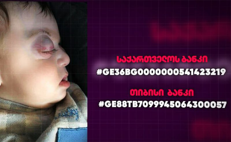 6 თვის ალექსანდრეს დახმარება სჭირდება