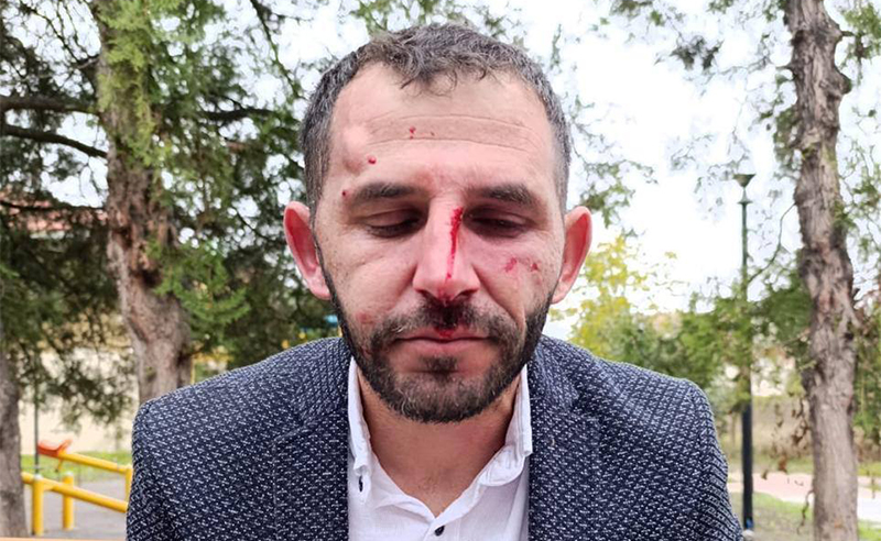 მარნეულში საარჩევნო უბანზე ენმ-ის წარმომადგენელს სცემეს