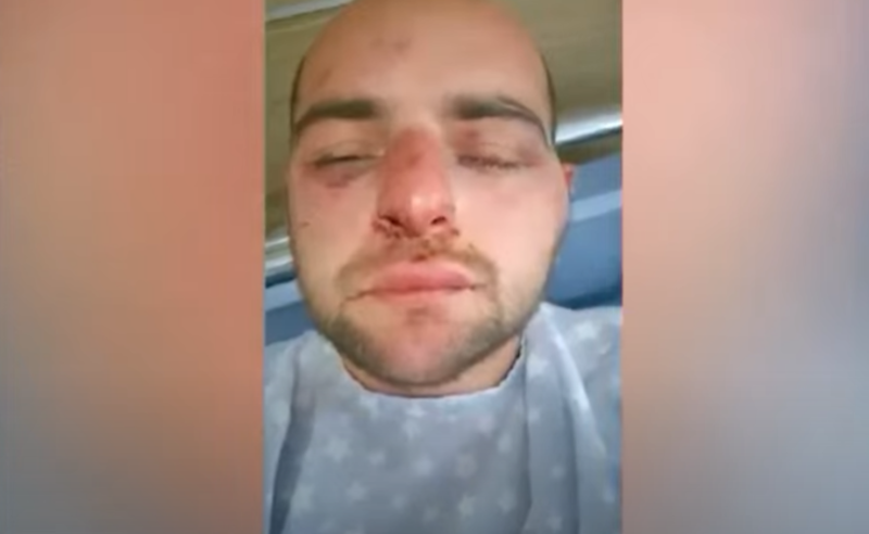 ვეღარ ვსუნთქავდი, ისე მირტყეს... ერთმა თქვა, "მოდი, თითი მოვტეხოთო" - ნაცემი აქციის მონაწილე