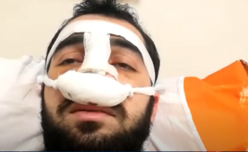 ერთ-ერთმა რობოკოპმა ცხვირში, როგორც "ბიტა", ისე შემომცხო, სისხლი თქრიალით მდიოდა - აქციის მონაწილე 