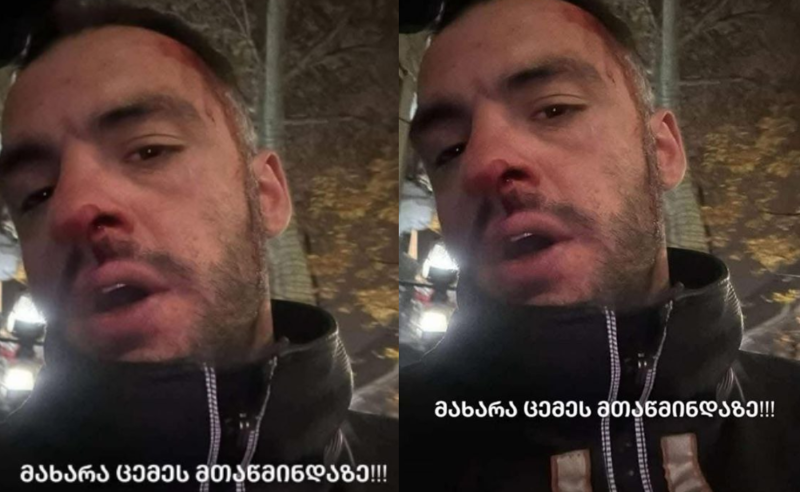 გიორგი მახარაძეს ფიზიკურად გაუსწორდნენ 