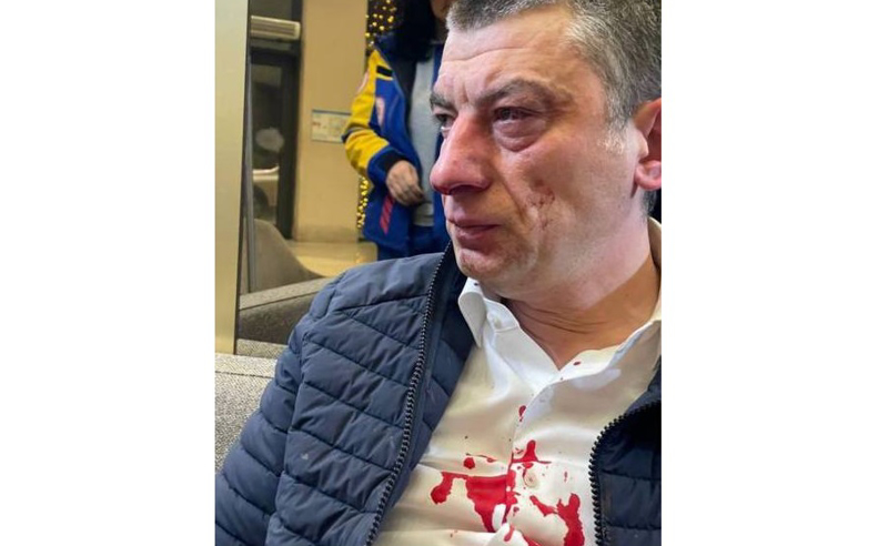 ეს არის დაშინების მცდელობა, რომელიც დასრულდება ივანიშვილის და მისი ბანდის კრახით - ხაზარაძე გახარიაზე თავდასხმაზე