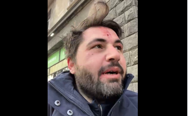 ლაშა გაბიტაშვილს თავს დაესხნენ და ფიზიკურად გაუსწორდნენ