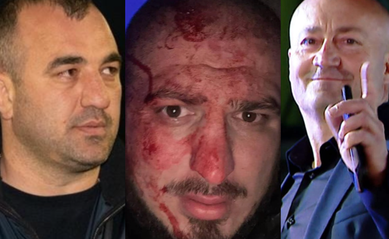 შინჯიკაშვილის გარემოცვის წევრი სასტიკად სცემეს - ერთ-ერთი ვერსიით, უბილავას ჩასაფრება "ხარებას" სპეცრაზმელებმა მოუწყვეს