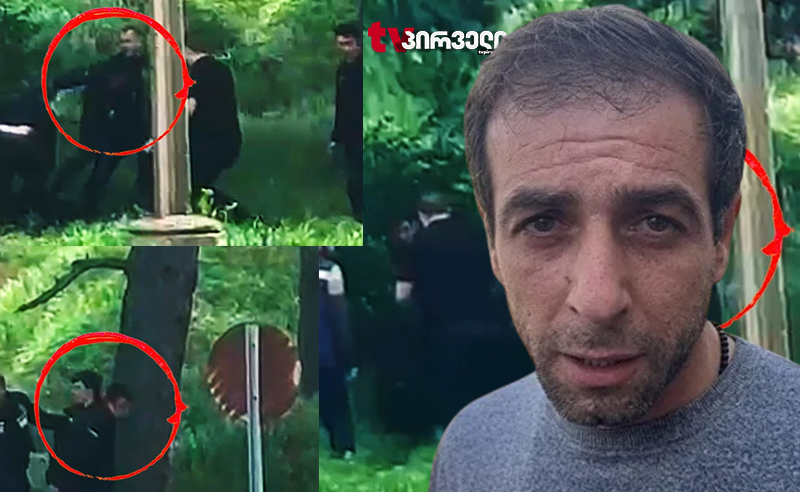 მე და ჩემი ძმაკაცი მაგრად გვცემეს - პირველი ინტერვიუ პოლიციელების მიერ ნაცემ კაცთან 